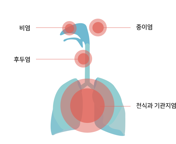 미세먼지는 비염,중이염,후두염,천식과 기관지염을 발생시킬수 있습니다.